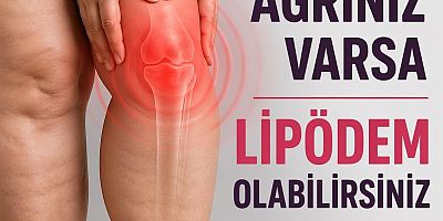 DİZ AĞRINIZ VARSA LİPÖDEM OLABİLİRSİNİZ